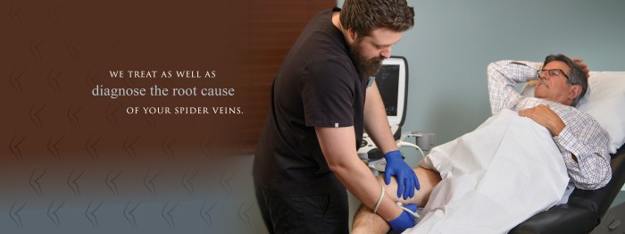 Veins vein vascular caused sclerotherapy woes varicose